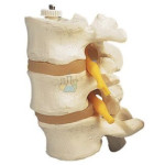 Three Lumbar Vertebrae Elastically Mounted Premium model